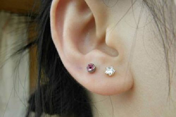 武漢市中心醫(yī)院可以打耳洞嗎 武漢激光打耳洞多少錢 武漢市中心醫(yī)院可以打耳洞嗎 武漢激光打耳洞多少錢