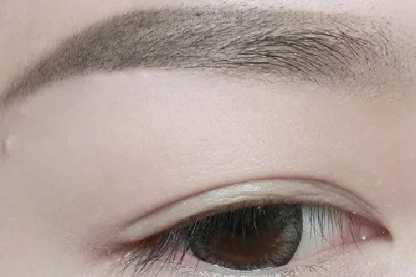 武漢激光洗眉毛的醫(yī)院推薦 武漢激光洗眉毛一般要多少錢 武漢激光洗眉毛的醫(yī)院推薦 武漢激光洗眉毛一般要多少錢