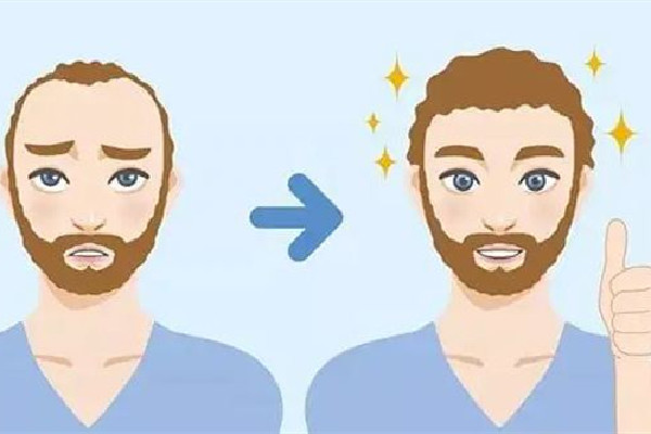 武漢發(fā)際線種植比較好的醫(yī)院 武漢發(fā)際線整形價格 武漢發(fā)際線種植比較好的醫(yī)院 武漢發(fā)際線整形價格