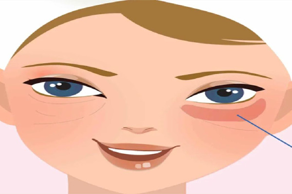 武漢打去眼袋針的醫(yī)院 武漢打去眼袋針多少錢 武漢打去眼袋針的醫(yī)院 武漢打去眼袋針多少錢