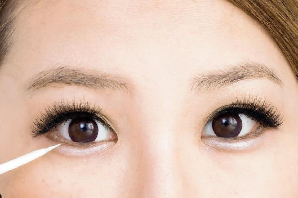 武漢填充臥蠶哪家好 武漢臥蠶手術(shù)哪個醫(yī)院做的好 武漢填充臥蠶哪家好 武漢臥蠶手術(shù)哪個醫(yī)院做的好