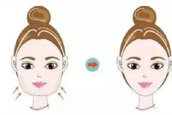 武漢面部吸脂價格大概多少錢 武漢面部吸脂醫(yī)院排行 武漢面部吸脂價格大概多少錢 武漢面部吸脂醫(yī)院排行