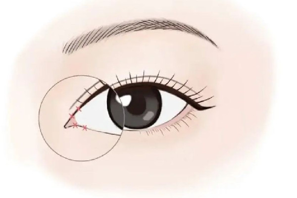 武漢整形眼睛修復(fù)哪家好 武漢眼部整形多少錢(qián) 武漢整形眼睛修復(fù)哪家好 武漢眼部整形多少錢(qián)