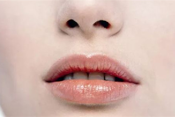 武漢脫唇毛哪個醫(yī)院最好 武漢協(xié)和醫(yī)院脫唇毛多少錢 武漢脫唇毛哪個醫(yī)院最好 武漢協(xié)和醫(yī)院脫唇毛多少錢