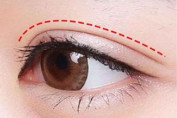 武漢眼角上揚(yáng)手術(shù)多少錢 武漢眼角上揚(yáng)手術(shù)去哪家醫(yī)院 武漢眼角上揚(yáng)手術(shù)多少錢 武漢眼角上揚(yáng)手術(shù)去哪家醫(yī)院