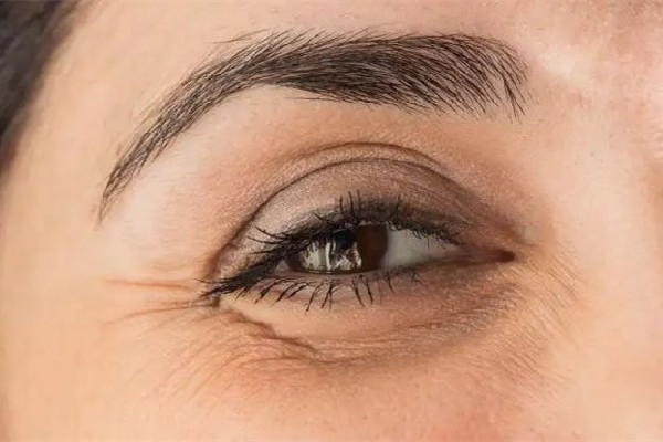 武漢眼角除皺針多少錢一針 武漢打眼角除皺針去哪里打 武漢眼角除皺針多少錢一針 武漢打眼角除皺針去哪里打