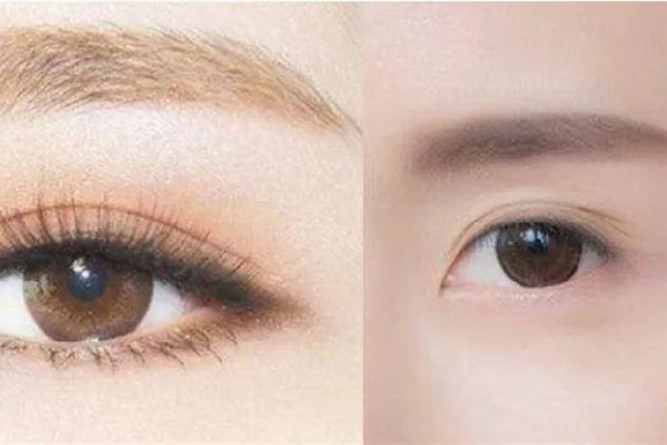 武漢眉骨修復(fù)哪里好 武漢眉骨修復(fù)多少錢 武漢眉骨修復(fù)哪里好 武漢眉骨修復(fù)多少錢