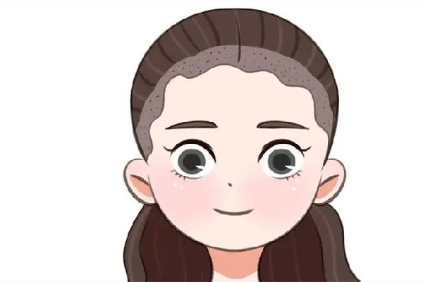 武漢發(fā)際線種植比較好的醫(yī)院 武漢發(fā)際線種植怎么收費 武漢發(fā)際線種植比較好的醫(yī)院 武漢發(fā)際線種植怎么收費