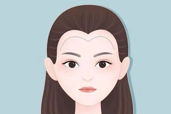 武漢做發(fā)際線一般多少錢啊 武漢做發(fā)際線的醫(yī)院 武漢做發(fā)際線一般多少錢啊 武漢做發(fā)際線的醫(yī)院