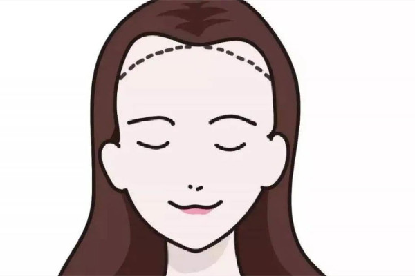 武漢做發(fā)際線一般多少錢啊 武漢做發(fā)際線的醫(yī)院 武漢做發(fā)際線一般多少錢啊 武漢做發(fā)際線的醫(yī)院