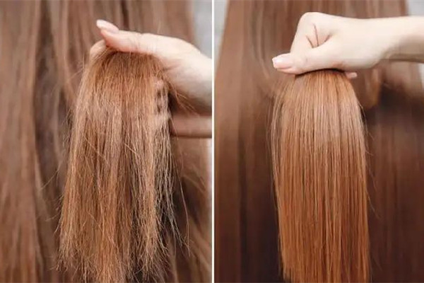 干性頭發(fā)會變成油性頭發(fā)嗎 干性頭發(fā)會導(dǎo)致頭皮屑嗎 干性頭發(fā)會變成油性頭發(fā)嗎 干性頭發(fā)會導(dǎo)致頭皮屑嗎