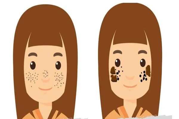 江漢路步行街萬阡國(guó)際專業(yè)祛斑·祛痣·祛疤連鎖店黑色素淡痣怎么