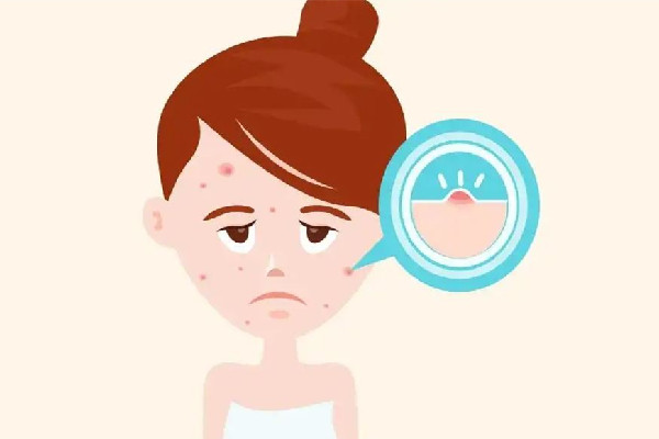 江漢路步行街雅衡詩蘭皮膚健康管理中心痘痘肌調(diào)理怎么樣 江漢路步行街雅衡詩蘭皮膚健康管理中心可以脫毛嗎 江漢路步行街雅衡詩蘭皮膚健康管理中心痘痘肌調(diào)理怎么樣 江漢路步行街雅衡詩蘭皮膚健康管理中心可以脫毛嗎