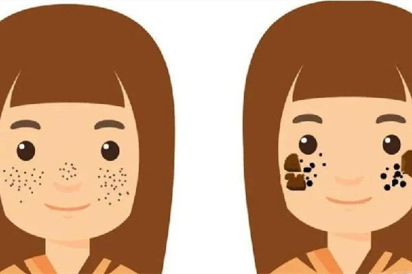 漢江路痣斑王祛痣祛斑店祛斑效果好嗎 漢江路痣斑王祛痣祛斑店祛痣怎么樣 漢江路痣斑王祛痣祛斑店祛斑效果好嗎 漢江路痣斑王祛痣祛斑店祛痣怎么樣