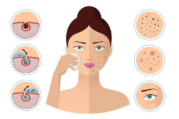 光谷W·SKIN皮膚管理中心毛孔清潔做的好嗎 光谷W·SKIN皮膚管理中心臉部護(hù)理做的怎么樣 光谷W·SKIN皮膚管理中心毛孔清潔做的好嗎 光谷W·SKIN皮膚管理中心臉部護(hù)理做的怎么樣