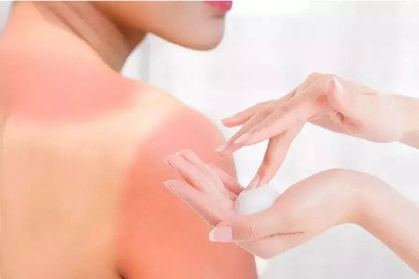 光谷EM輕松時(shí)刻科技美容面部修復(fù)項(xiàng)目感覺怎么樣 曬后修復(fù)用蘆薈膠有用嗎