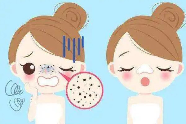 光谷MG問題皮膚管理中心去黑頭體驗怎么樣 去黑頭去美容院有用嗎 光谷MG問題皮膚管理中心去黑頭體驗怎么樣 去黑頭去美容院有用嗎