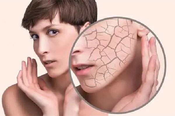 光谷天地SKINOGY顏可諾醫(yī)研護(hù)膚中心深層補(bǔ)水項目做得怎么樣 深層補(bǔ)水的好處