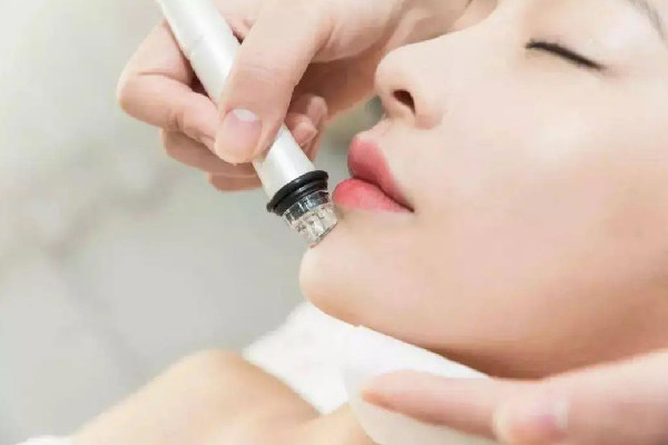 水果湖清顏堂專業(yè)祛痘小氣泡體驗感怎么樣 小氣泡可以縮小毛孔嗎 水果湖清顏堂專業(yè)祛痘小氣泡體驗感怎么樣 小氣泡可以縮小毛孔嗎