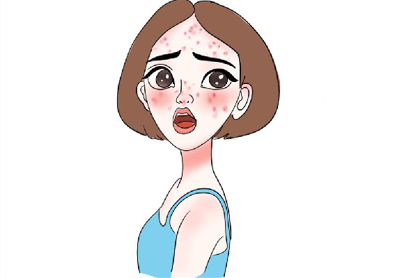 積玉橋vup·科技美膚·祛斑·祛痘連鎖痘痘肌護(hù)理怎么樣 痘痘肌用什洗面奶 積玉橋vup·科技美膚·祛斑·祛痘連鎖痘痘肌護(hù)理怎么樣 痘痘肌用什洗面奶