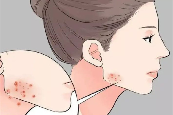 積玉橋vup·科技美膚·祛斑·祛痘連鎖痘痘肌護(hù)理怎么樣 痘痘肌用什洗面奶 積玉橋vup·科技美膚·祛斑·祛痘連鎖痘痘肌護(hù)理怎么樣 痘痘肌用什洗面奶