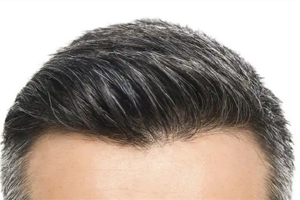 白頭發(fā)染了會越來越多嗎 白頭發(fā)染黑能維持多久 白頭發(fā)染了會越來越多嗎 白頭發(fā)染黑能維持多久