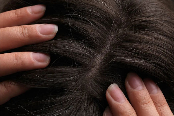 白頭發(fā)染了會越來越多嗎 白頭發(fā)染黑能維持多久 白頭發(fā)染了會越來越多嗎 白頭發(fā)染黑能維持多久