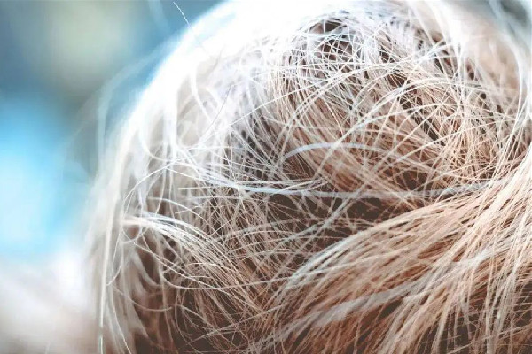 白頭發(fā)可以逆轉(zhuǎn)嗎 白頭發(fā)還能變黑嗎 白頭發(fā)可以逆轉(zhuǎn)嗎 白頭發(fā)還能變黑嗎