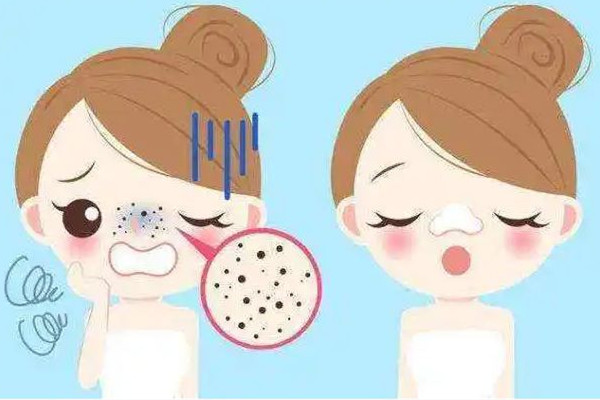 中南路漾膚皮膚管理去黑頭效果好不好 去黑頭有什么副作用嗎 中南路漾膚皮膚管理去黑頭效果好不好 去黑頭有什么副作用嗎