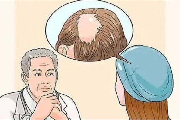 掉發(fā)要去看醫(yī)生嗎 掉發(fā)要查激素嗎 掉發(fā)要去看醫(yī)生嗎 掉發(fā)要查激素嗎