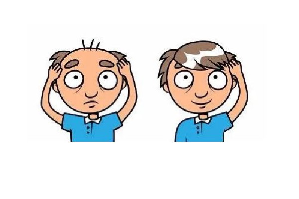 掉發(fā)能用生姜洗發(fā)水嗎 掉發(fā)用生姜洗發(fā)水管用嗎 掉發(fā)能用生姜洗發(fā)水嗎 掉發(fā)用生姜洗發(fā)水管用嗎