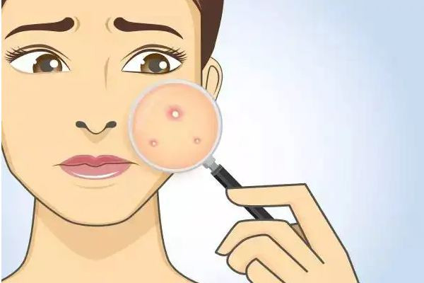 中南路痘醫(yī)堂祛痘祛斑皮膚管理中心店祛痘項(xiàng)目做的怎么樣 祛痘要多久才能完全好 中南路痘醫(yī)堂祛痘祛斑皮膚管理中心店祛痘項(xiàng)目做的怎么樣 祛痘要多久才能完全好