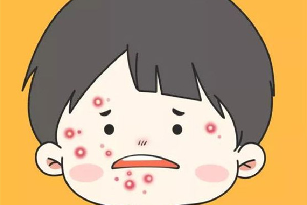 中南路佐康專(zhuān)業(yè)祛痘店全臉祛痘怎么樣 痘痘可以擠掉嗎