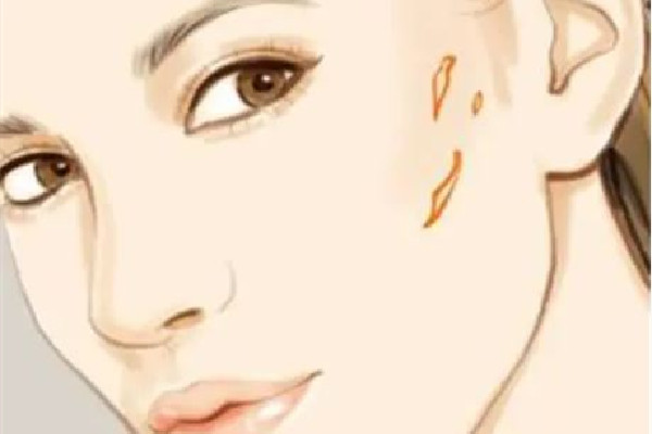 中南路欣奕除疤祛痘全國(guó)連鎖機(jī)構(gòu)祛疤效果怎么樣 祛疤是越早越好嗎 中南路欣奕除疤祛痘全國(guó)連鎖機(jī)構(gòu)祛疤效果怎么樣 祛疤是越早越好嗎