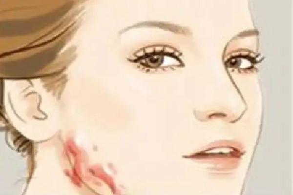 中南路欣奕除疤祛痘全國(guó)連鎖機(jī)構(gòu)祛疤效果怎么樣 祛疤是越早越好嗎 中南路欣奕除疤祛痘全國(guó)連鎖機(jī)構(gòu)祛疤效果怎么樣 祛疤是越早越好嗎