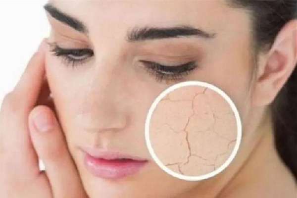 中南路丹鳳眼國際眼部美容連鎖機(jī)構(gòu)可以緩解面部干燥嗎 面部干燥怎么補(bǔ)水效果好 中南路丹鳳眼國際眼部美容連鎖機(jī)構(gòu)可以緩解面部干燥嗎 面部干燥怎么補(bǔ)水效果好