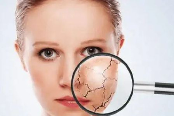 中南路丹鳳眼國際眼部美容連鎖機(jī)構(gòu)可以緩解面部干燥嗎 面部干燥怎么補(bǔ)水效果好 中南路丹鳳眼國際眼部美容連鎖機(jī)構(gòu)可以緩解面部干燥嗎 面部干燥怎么補(bǔ)水效果好