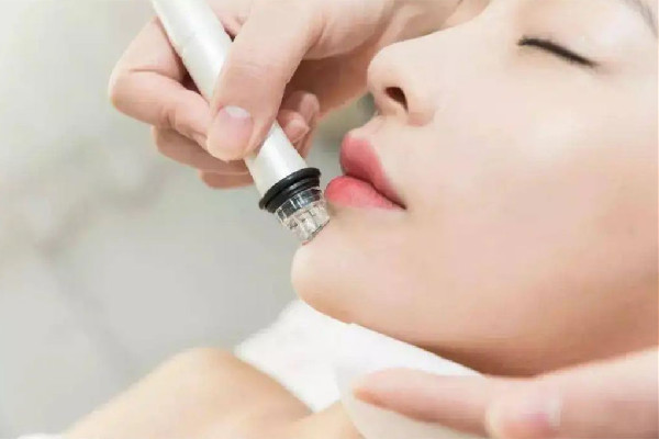 后湖SOR索爾祛痘?面部肌膚科學(xué)管理小氣泡項(xiàng)目感覺(jué)好嗎 小氣泡有收縮毛孔作用嗎