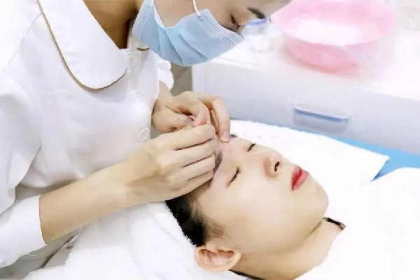 后湖SOR索爾祛痘?面部肌膚科學(xué)管理針清效果怎么樣 針清會讓毛孔變大嗎 后湖SOR索爾祛痘?面部肌膚科學(xué)管理針清效果怎么樣 針清會讓毛孔變大嗎