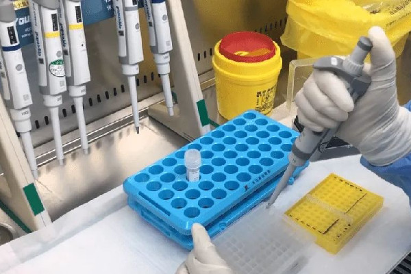 核酸機構造假頻現(xiàn) 官方:嚴肅處置 專家:核酸檢測公司該不該上市 核酸機構造假頻現(xiàn) 官方:嚴肅處置 專家:核酸檢測公司該不該上市