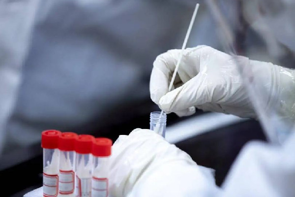 核酸機構造假頻現(xiàn) 官方:嚴肅處置 專家:核酸檢測公司該不該上市 核酸機構造假頻現(xiàn) 官方:嚴肅處置 專家:核酸檢測公司該不該上市