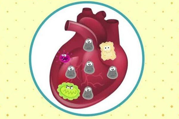 心肌炎有什么癥狀和表現(xiàn) 心肌炎會(huì)發(fā)燒嗎 心肌炎有什么癥狀和表現(xiàn) 心肌炎會(huì)發(fā)燒嗎