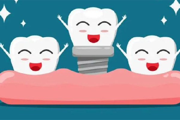 種植牙萬元時代即將結束 種牙為什么這么貴 種植牙萬元時代即將結束 種牙為什么這么貴