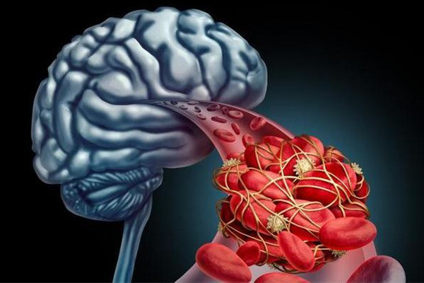 75歲老人中風好友發(fā)現(xiàn)步數(shù)為0報警 老年人中風要注意什么 75歲老人中風好友發(fā)現(xiàn)步數(shù)為0報警 老年人中風要注意什么