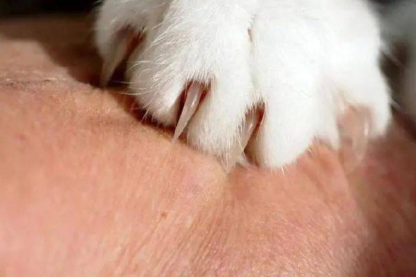 男子擼貓后淋巴結(jié)腫大高燒不退 被貓抓了怎么判斷沒(méi)事 男子擼貓后淋巴結(jié)腫大高燒不退 被貓抓了怎么判斷沒(méi)事