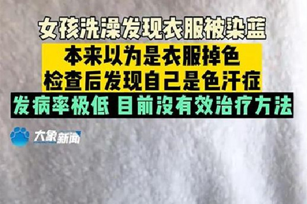女孩出汗把衣服染藍(lán)查出色汗癥 出汗有顏色正常嗎 女孩出汗把衣服染藍(lán)查出色汗癥 出汗有顏色正常嗎