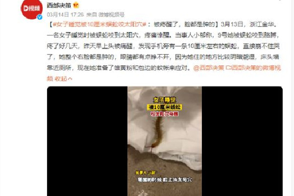 女子睡覺時(shí)被10厘米蜈蚣咬太陽穴 被蜈蚣咬了會有生命危險(xiǎn)嗎